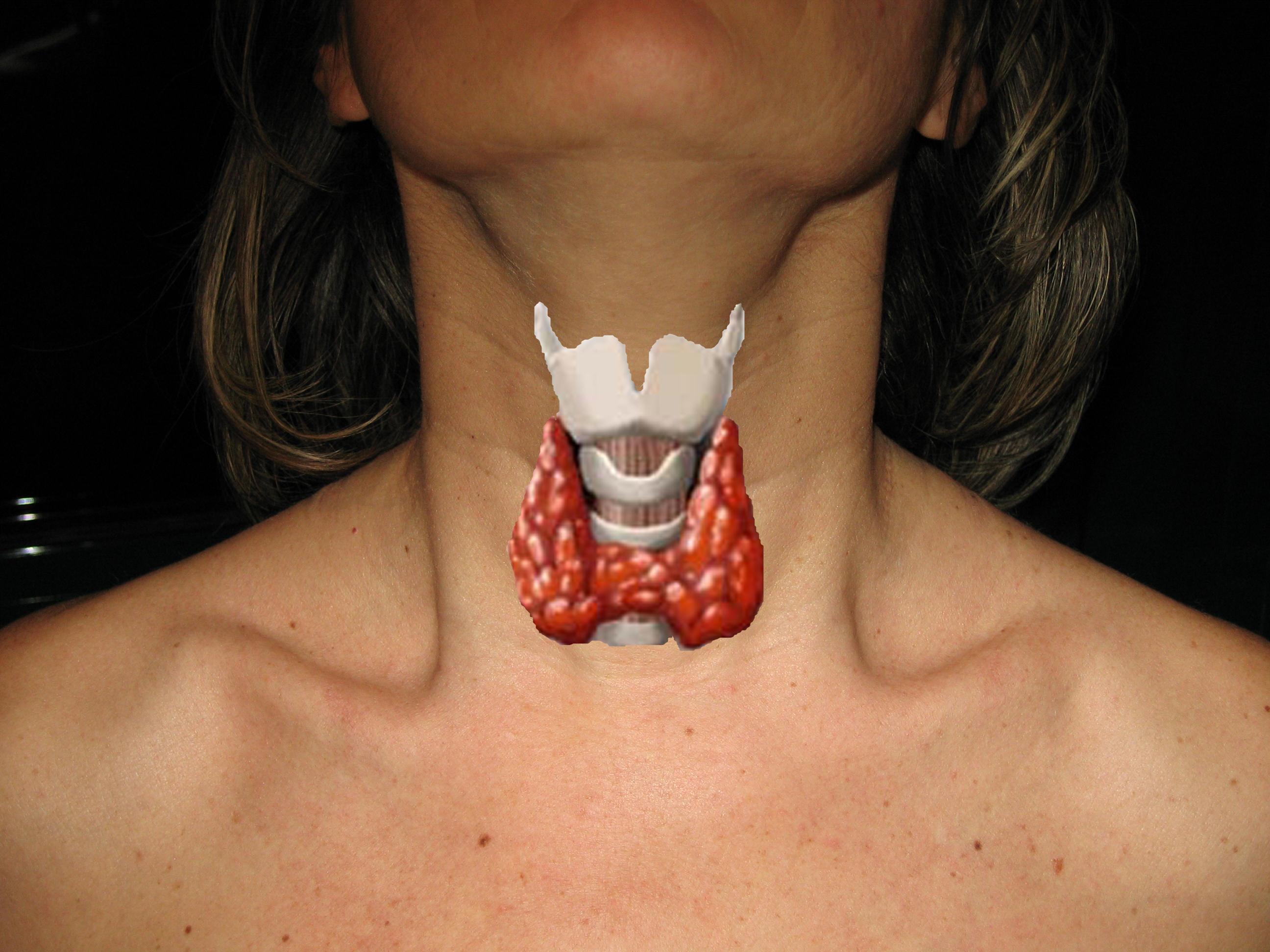 Rappresentazione schematica della tiroide